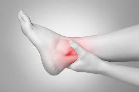 Swollen Ankles Could Signal Early Heart Failure Risk