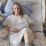 A North Vancouver pedestrian faces possible leg amputation after a hit-and-run crash. Police search for the driver and ask witnesses to come forward.