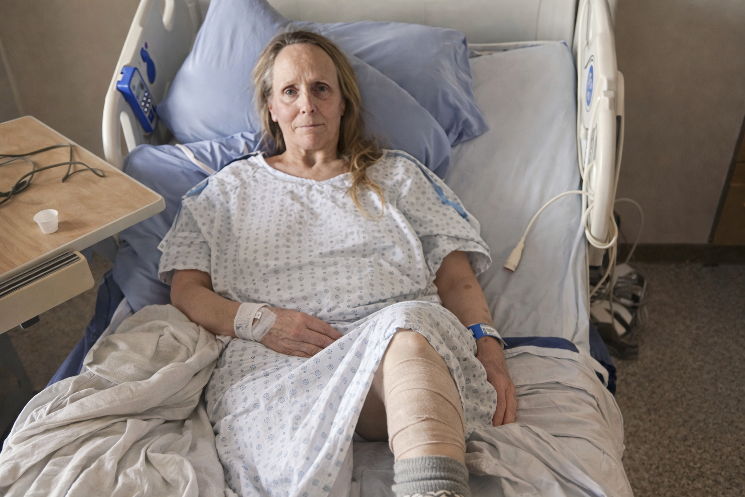 A North Vancouver pedestrian faces possible leg amputation after a hit-and-run crash. Police search for the driver and ask witnesses to come forward.